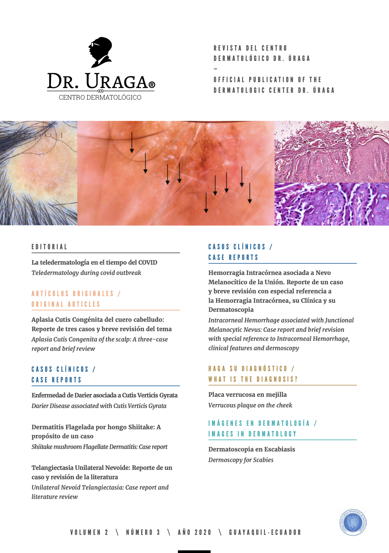 					Ver Vol. 2 Núm. 3 (2020): Revista Dermatológica Centro Úraga
				